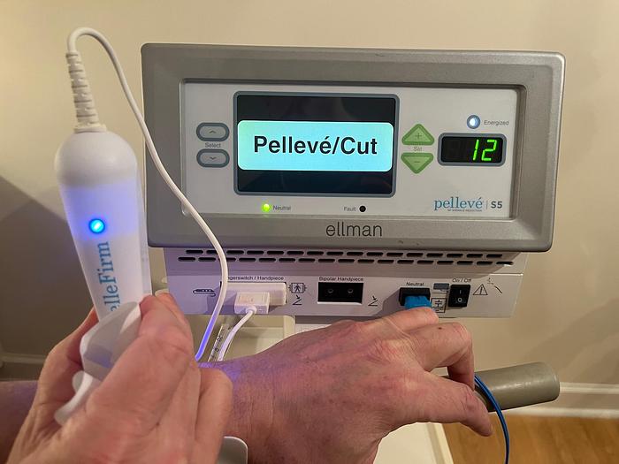 Used Ellman Pelleve S5 IEC RF Wrinkle Reduction System w/ accesories