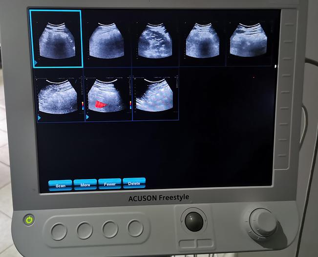 Gebraucht Siemens Acuson Freestyle Flachbildschirm portabel diagnostik Ultraschallgerät mit kabellosen Schallköpfen auf Trolley