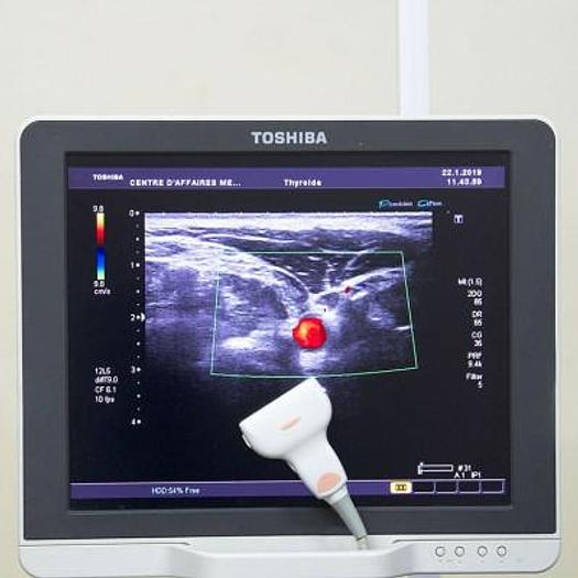 D'occasion ECHOGRAPHE TOSHIBA XARIO COULEUR DOPPLER AVEC 3 SONDES ET ÉCRAN PLAT