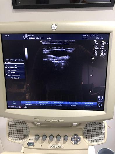 Gebraucht GE LOGIQ A5 Ultraschallgerät mit 2x Sonden und