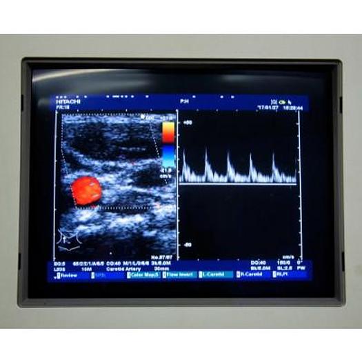 Used ECHOGRAPHE HITACHI EUB-6500 AVEC 2 SONDES
