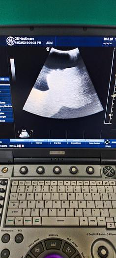 Gebraucht GE Ultrasonde 4C-RS