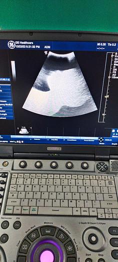 Gebraucht GE Ultrasonde 4C-RS