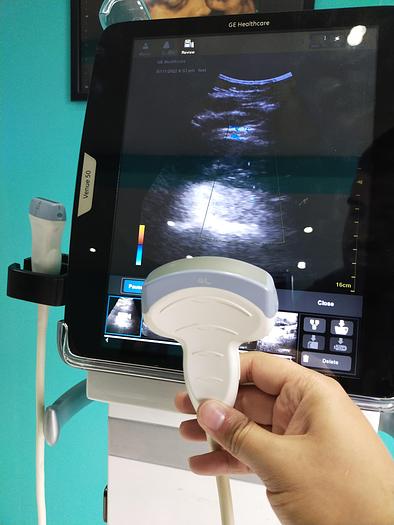Gebraucht GE Healthcare Ultraschalgerät mit 2 Sonden