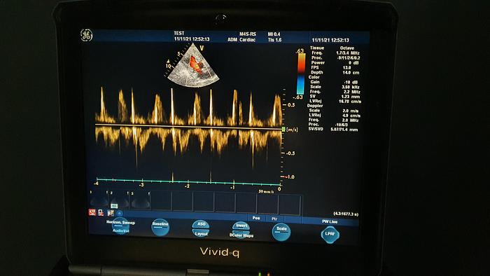 Gebraucht GE Vivid Q Ultraschallgerät
