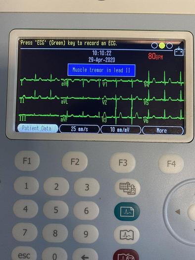 Gebraucht GE Mac 600 EKG System mit 10 adriges EKG Kabeln