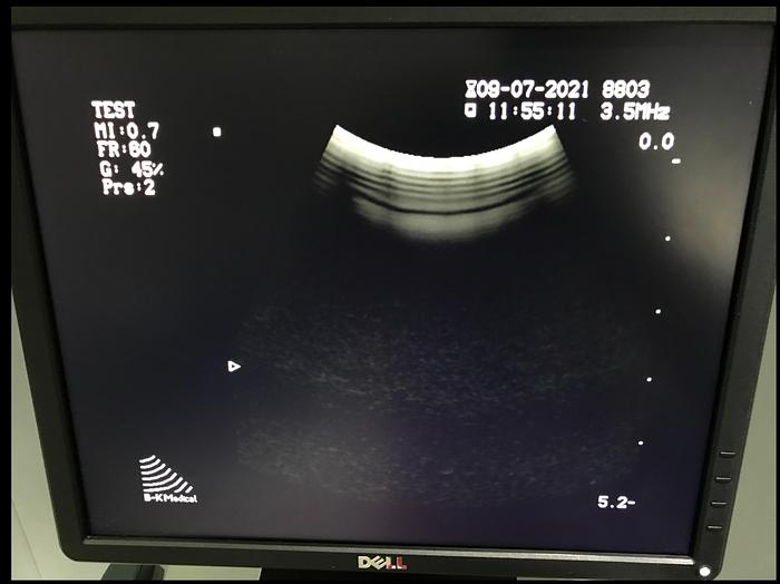 Gebraucht BK Medical 2101 Falcon Ultraschallgerät mit 3 Sonden und Sony Drucker
