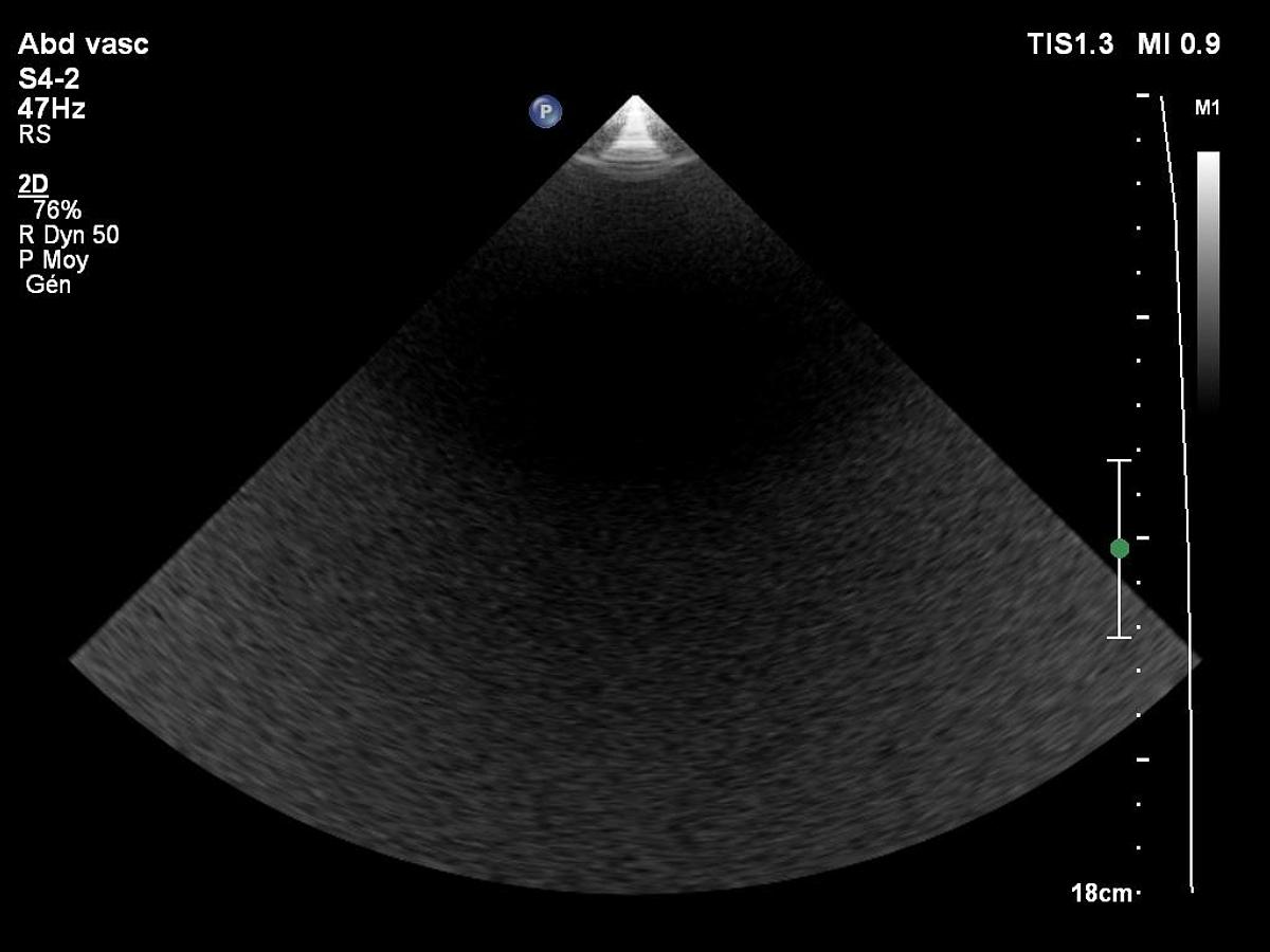 D'occasion Philips S4-2