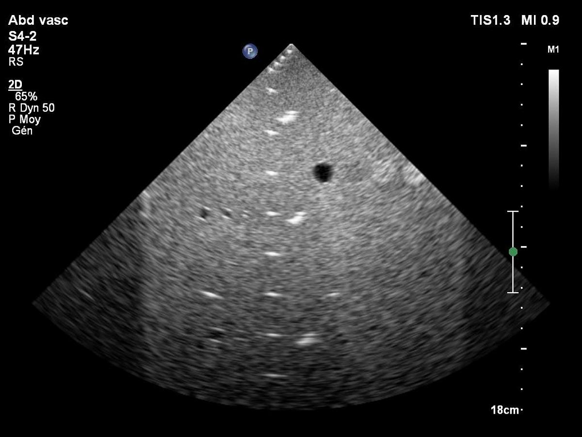 D'occasion Philips S4-2