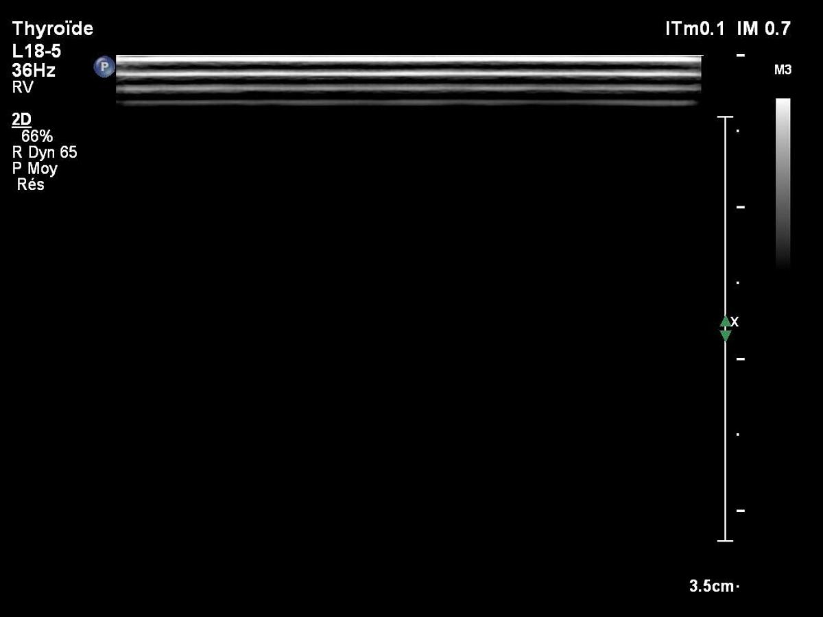 D'occasion Philips L18-5