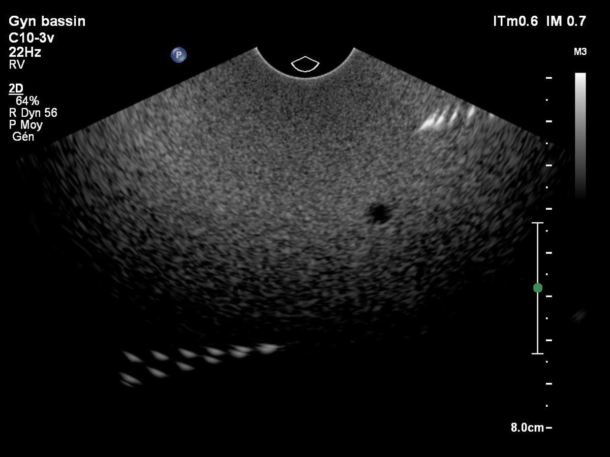 D'occasion Philips C10-3V