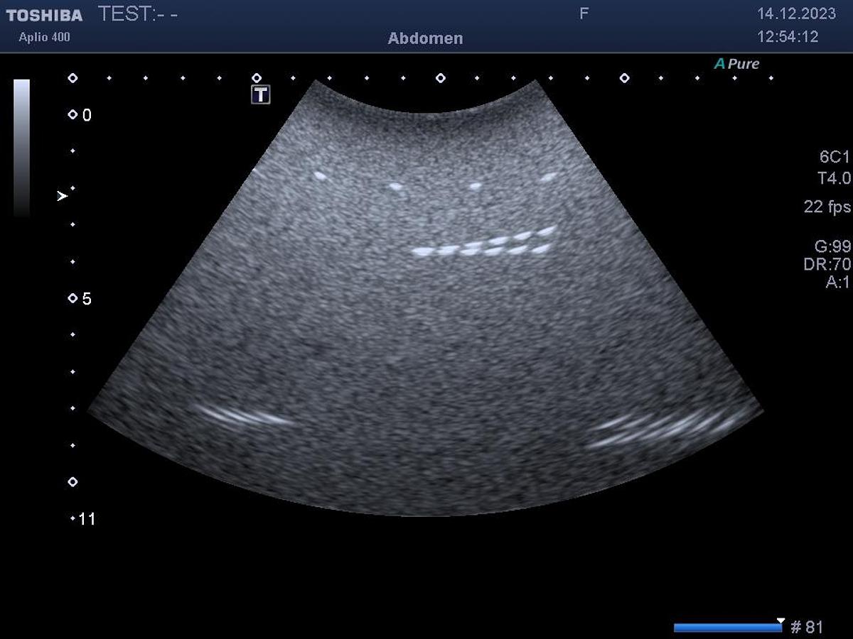 D'occasion Toshiba / Canon PVT375BT