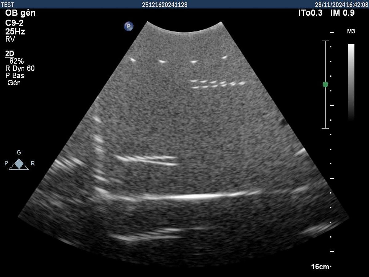 D'occasion Philips C9-2