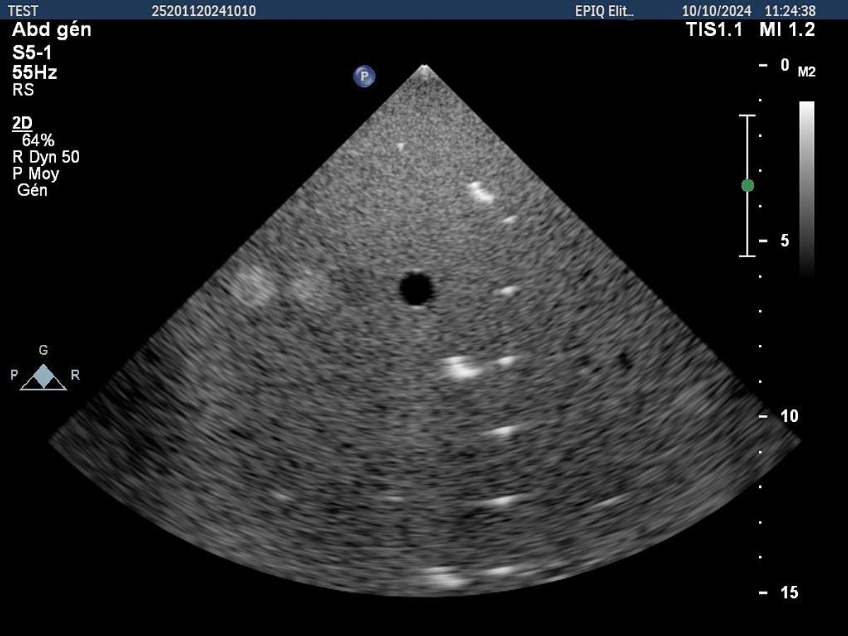 D'occasion Philips S5-1