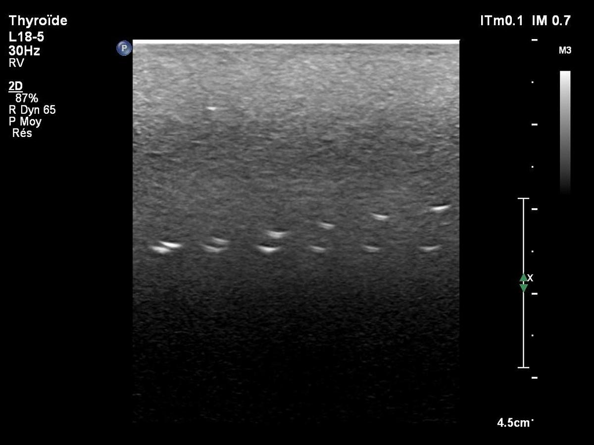 D'occasion Philips L18-5