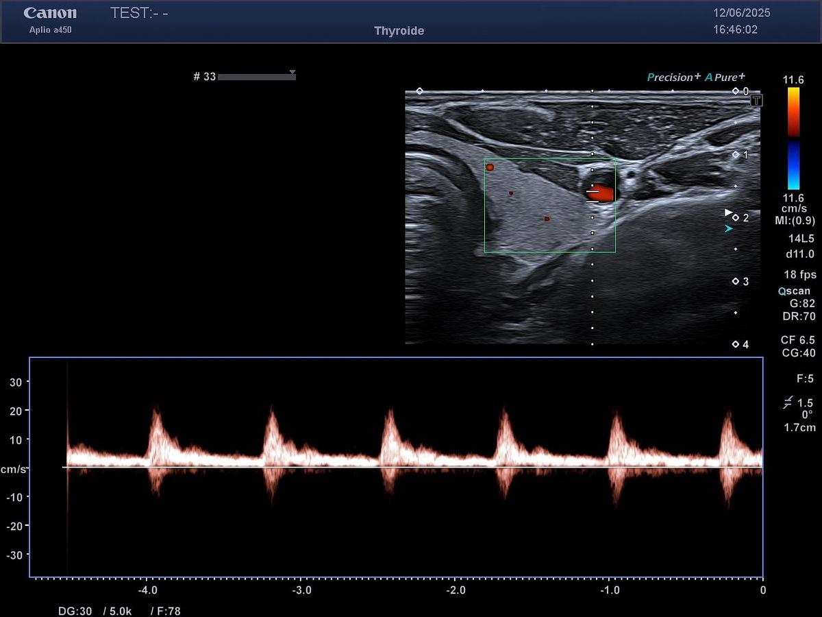 D'occasion Toshiba / Canon PLT1005BT