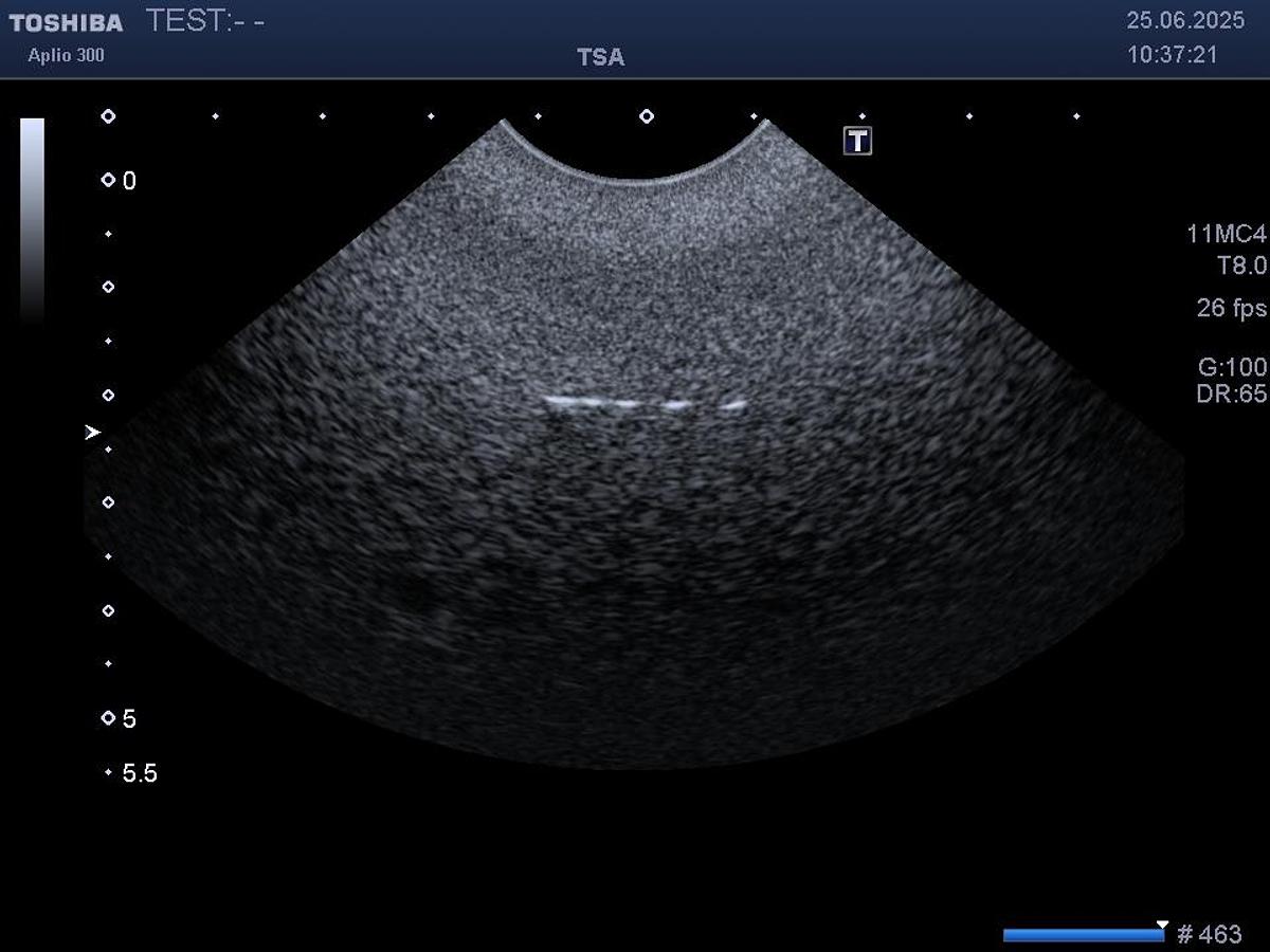 2025 Toshiba / Canon PVT712BT