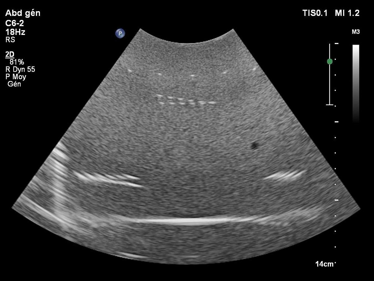 D'occasion Philips C6-2
