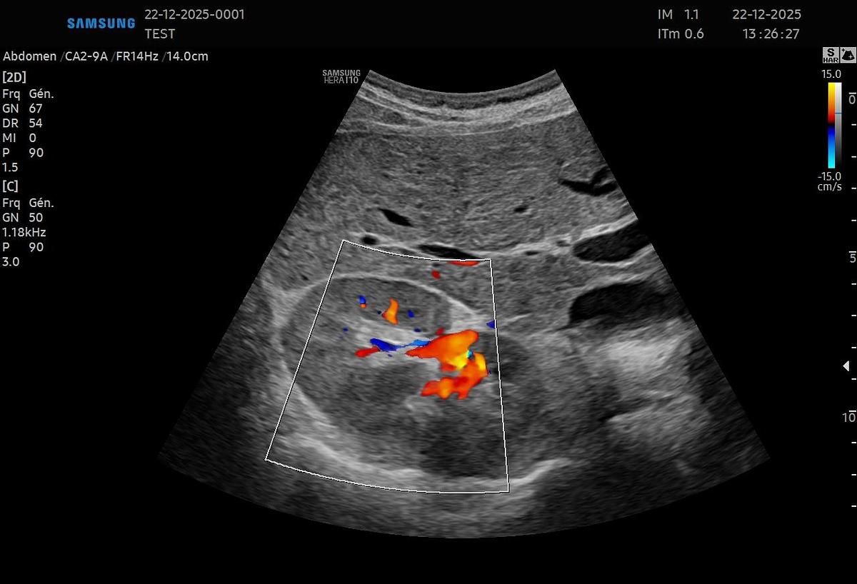 D'occasion Samsung CA2-9A