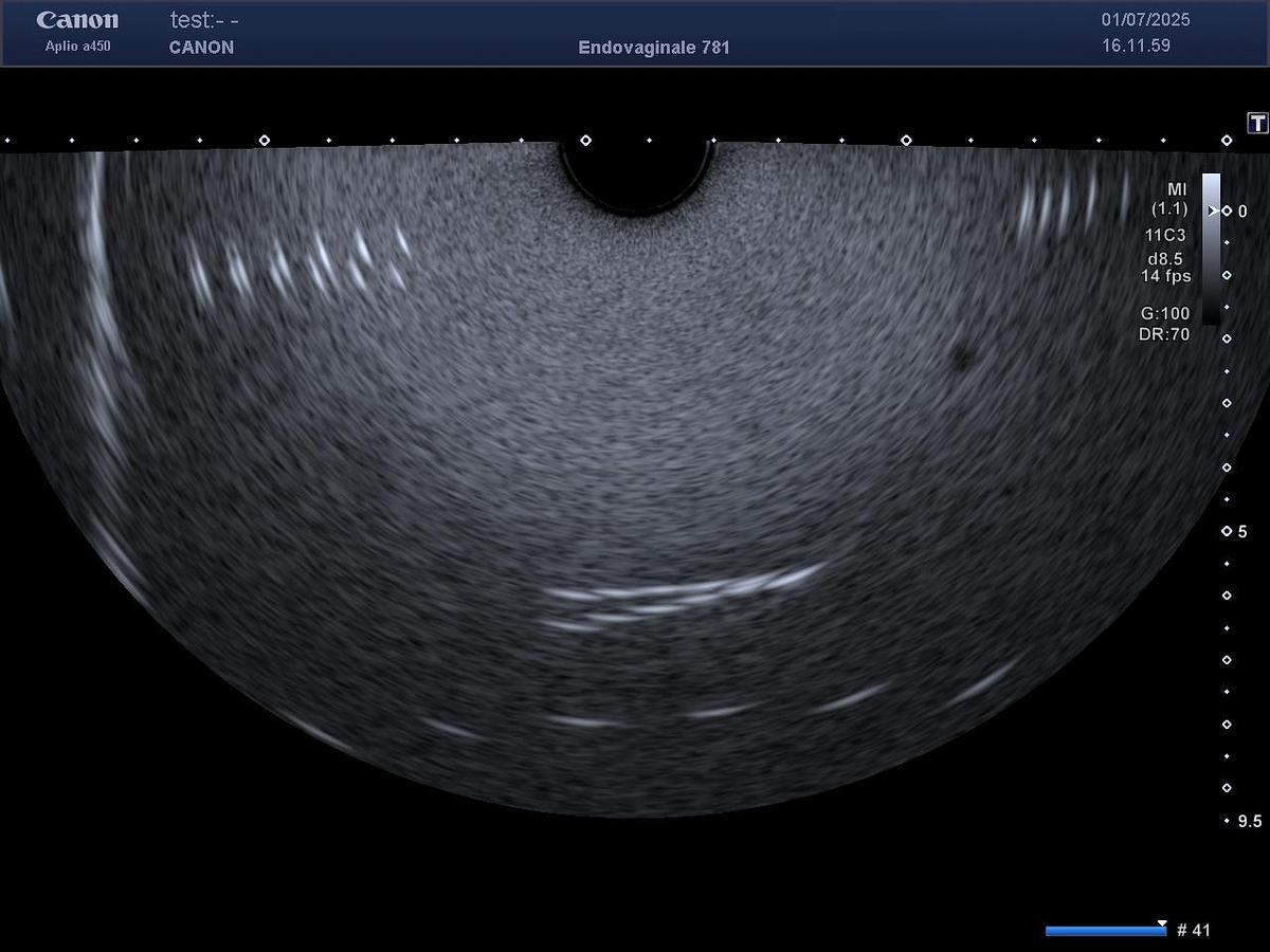 D'occasion Toshiba / Canon PVT781VT