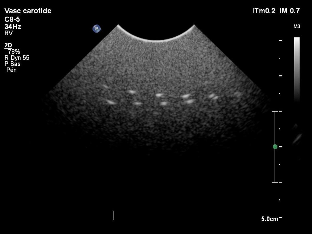 D'occasion Philips C8-5