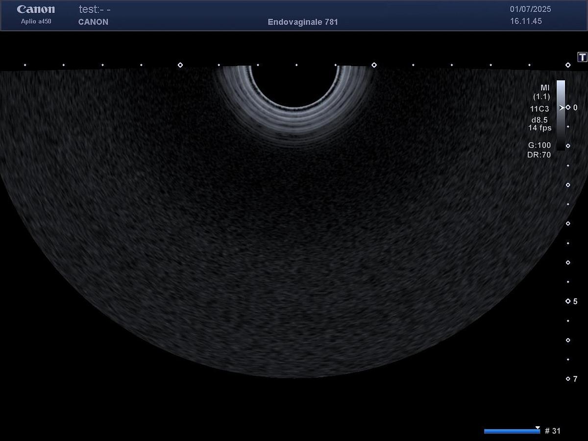 D'occasion Toshiba / Canon PVT781VT