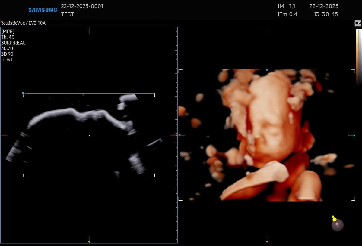 D'occasion Samsung EV2-10A