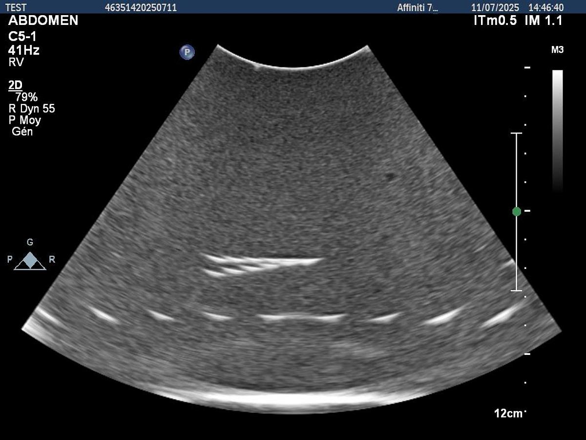 D'occasion Philips C5-1