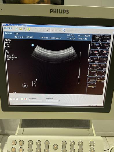 Gebraucht Philips HD 11 XE Ultraschallgerät mit 5x Sonden