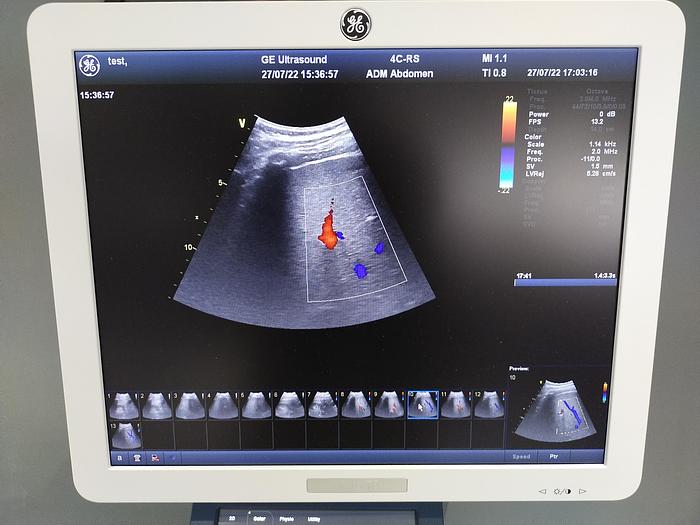 Gebraucht GE Vivid T8 Ultraschallsystem für Herz- und Gefäß-Ultraschall mit Kardio Sonde SW: R1.0.7