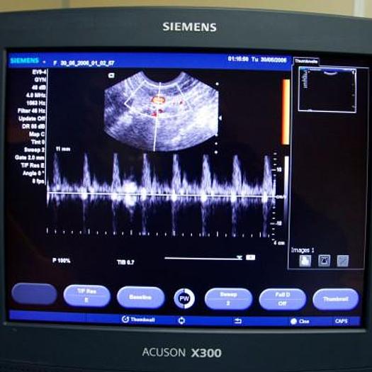 D'occasion ECHOGRAPHE SIEMENS ACUSON X300 AVEC 4 SONDES ET ECRAN PLAT