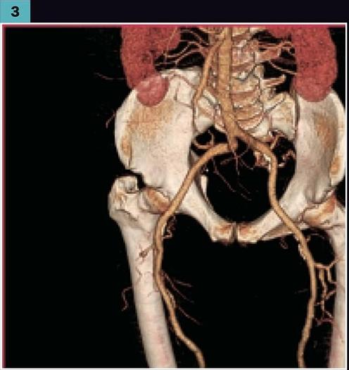 Reformado 2005 General Electric (GE) LightSpeed VCT