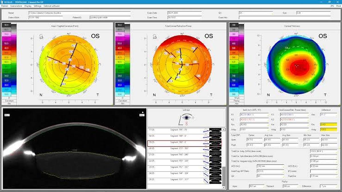 Used Oculas Pentacam AXL Corneal Topographer- Ophthalmic Equipment