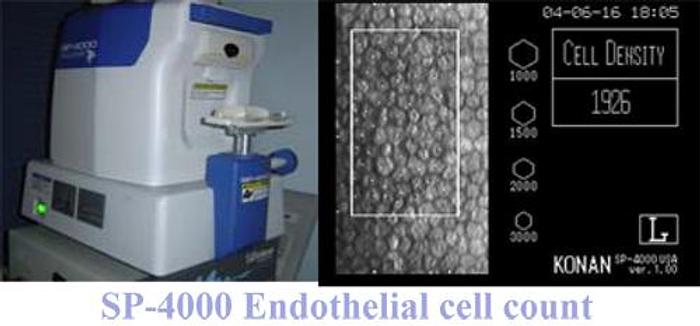 Refurbished Konan Cellchek SP 4000 Specular Microscope