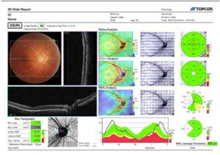 Refurbished Topcon Maestro 2 OCT and Fundus Camera