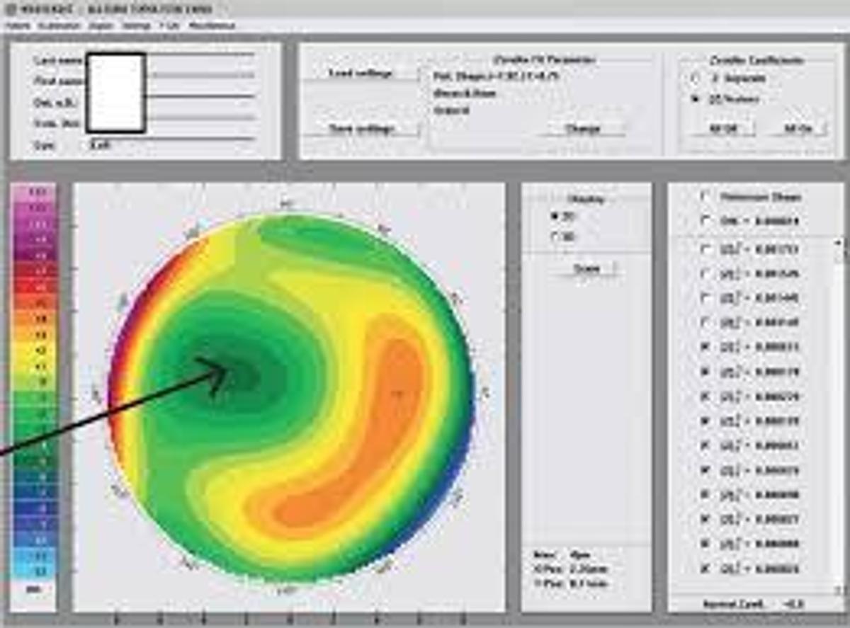 Refurbished Alcon Wavelight Vario Topolyzer Model 1028- Ophthalmic Equipment
