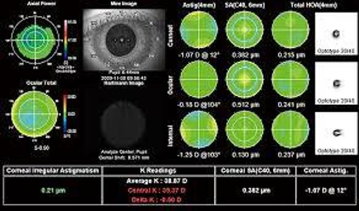 Refurbished Topcon KR 1W Auto Refractor/ Keratometer/ Topographer/ Wavefront Abberometer/ Pupilometer