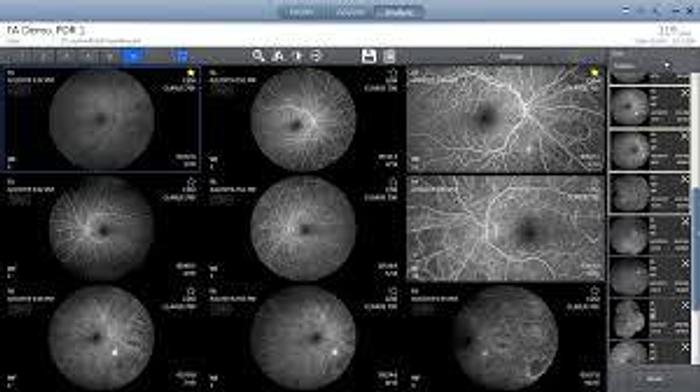 Used Humphrey/ Zeiss Clarus 700 FA, FAF, ICG