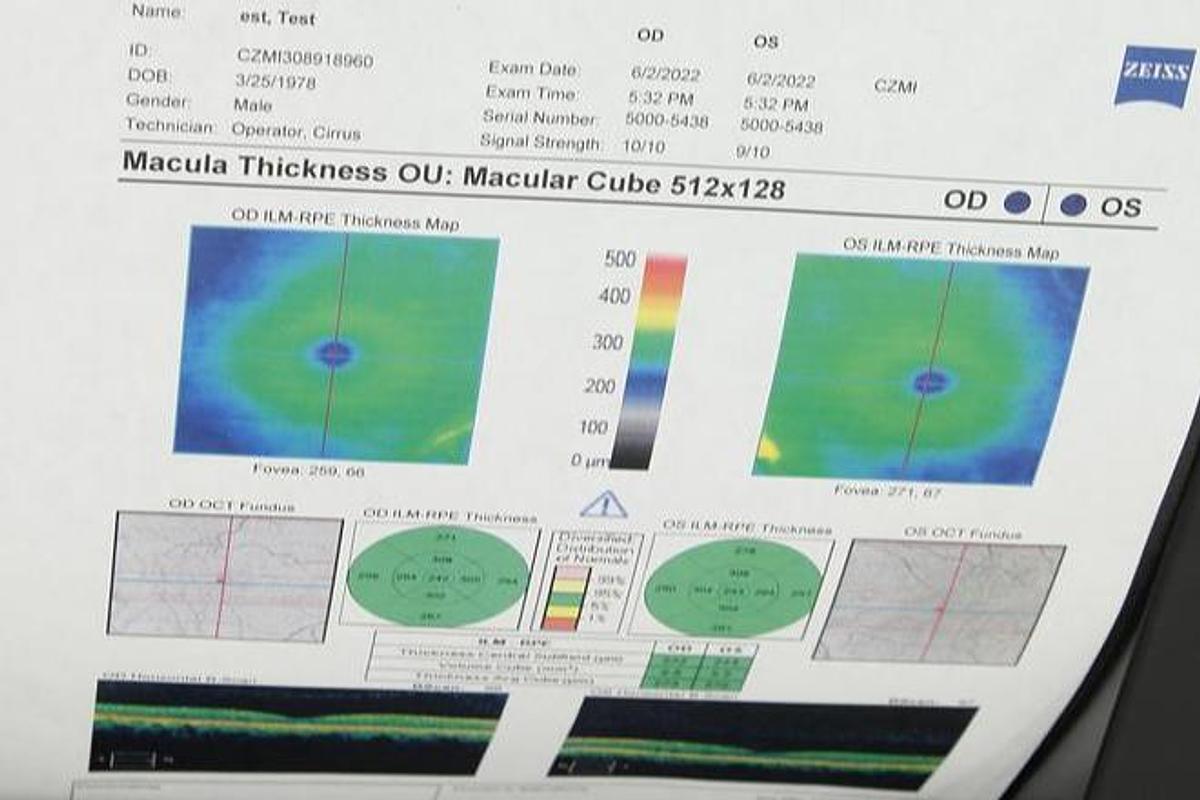 Refurbished Humphrey/ Zeiss Cirrus 5000 OCT Tomographer Wind 10