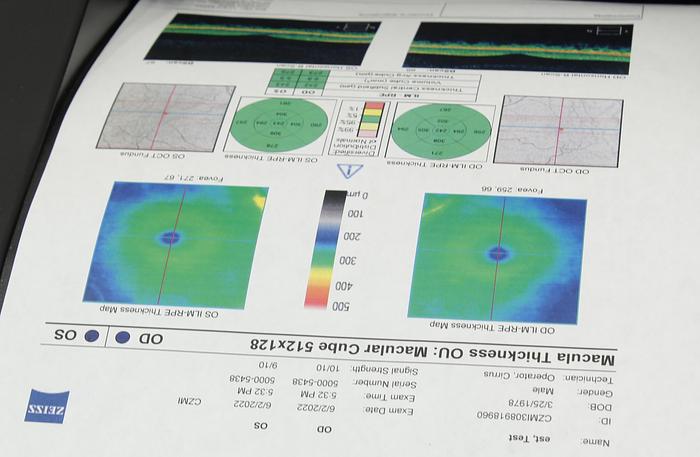 Refurbished Humphrey/ Zeiss Cirrus 5000 OCT Tomographer Wind 10