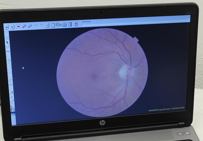 Refurbished Topcon NW 6S Fundus Camera