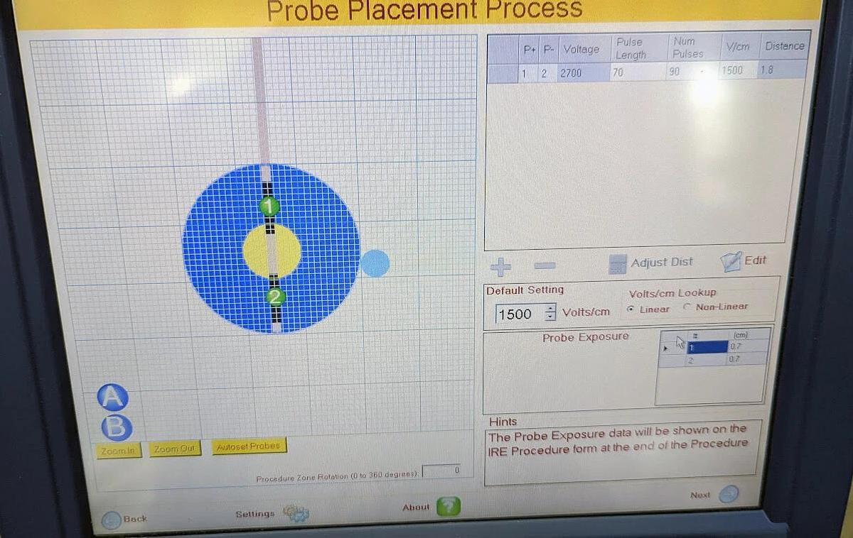 Used AngioDynamics HVP01 Nanoknife System