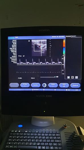 Gebraucht Siemens Acuson X300