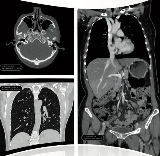 Refurbished 2008 General Electric (GE) LightSpeed VCT