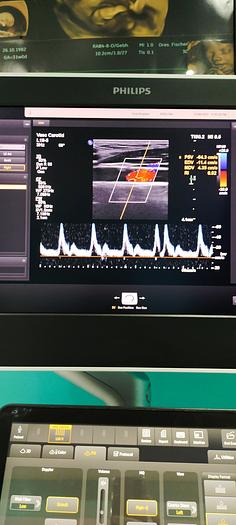 Gebraucht L18-5 Breitband-Linear-Schallkopf