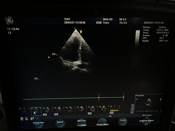 Gebraucht GE Vivid q Ultraschallgerät auf Vivid i Trolley mit 2 Sonden und EKG Kabel