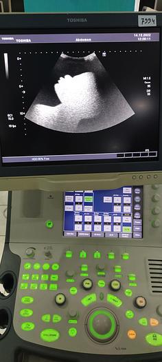 Gebraucht Toshiba PVT-375 Konvex Ultraschallsonde