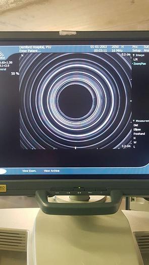 Used For Sale BK ULTRASOUND BK 2050 Ultrasound Transducer