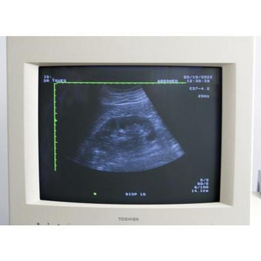 Used ECHOCARDIOGRAPHE TOSHIBA POWERVISION 6000 AVEC 3 SONDES