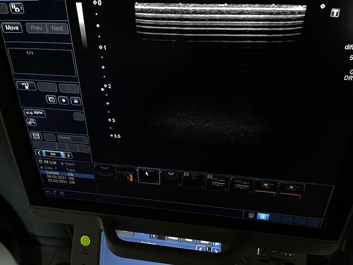 Used Ultraschallgerät Aplio 400 mit 3x Sonden und Printer